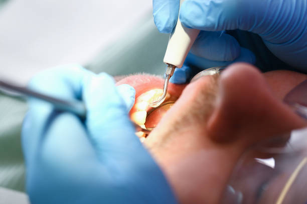 Best Dentist for Tooth Abscess  in Bayport, NY